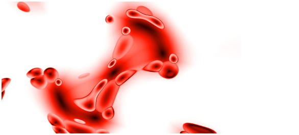 กดไขกระดูก กดไขกระดูก