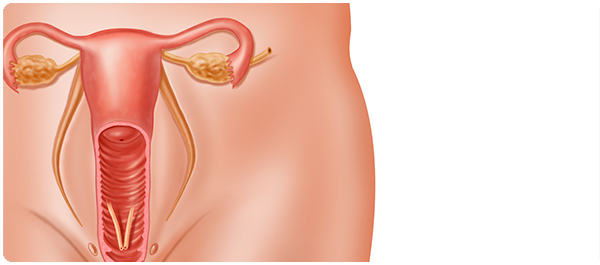 ขูดมดลูกเรื่องเฉพาะของผู้หญิง ขูดมดลูกเรื่องเฉพาะของผู้หญิง