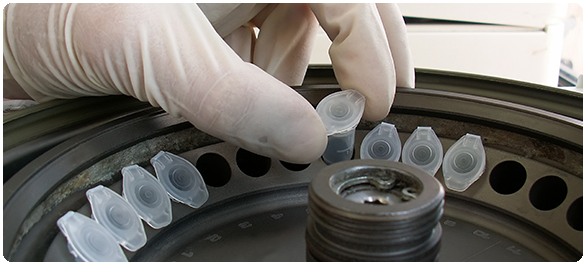 คีโตน คีโตน