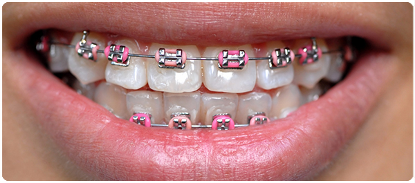 ติดเชื้อแค่ในช่องปาก ติดเชื้อแค่ในช่องปาก