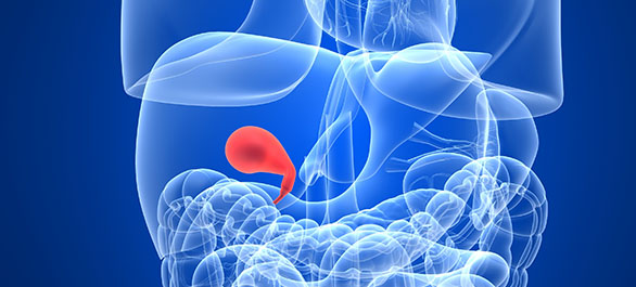 ถุงน้ำดีอักเสบ-3