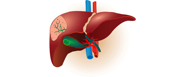 น้ำดี น้ำดี