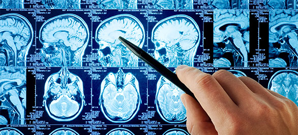 น้ำท่วมสมอง-6 น้ำท่วมสมอง-6