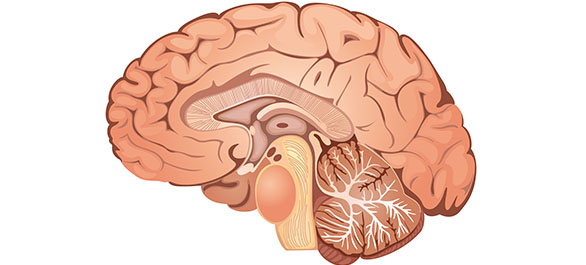 น้ำท่วมสมอง-1 น้ำท่วมสมอง-1