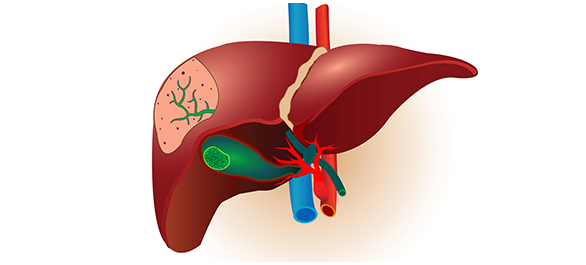 บิลิรูบิน <a href='https://www.honestdocs.co/colostrum-many-great-benefits' target='_blank'>บิลิรูบิน</a>