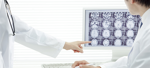 ปวดหัวดั่งสายฟ้าฟาด-1 ปวดหัวดั่งสายฟ้าฟาด-1