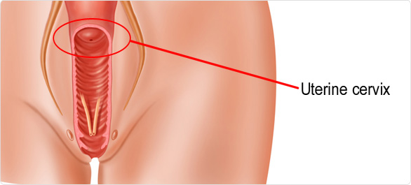 ปากมดลูก <a href='https://www.honestdocs.co/vaginal-discharge' target='_blank'>ปากมดลูก</a>