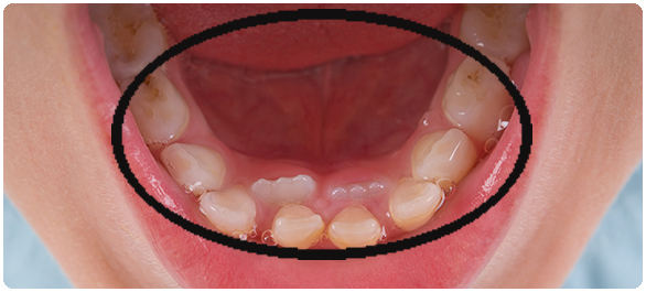 พื้นปาก พื้นปาก