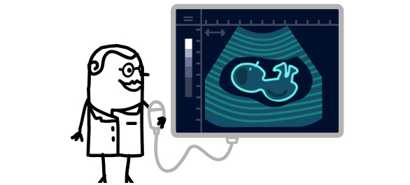 ภาวะรกเสื่อม ภาวะรกเสื่อม