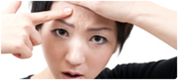 ยารักษาสิว ยารักษาสิว