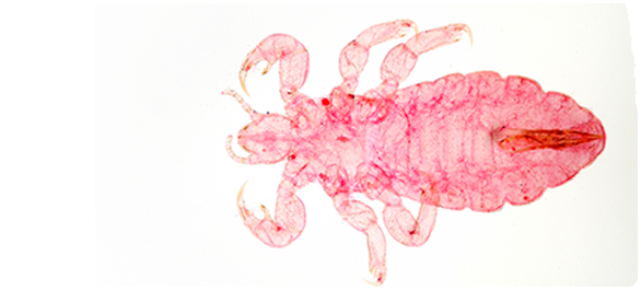 ยารักษาโรคเหา ยารักษาโรคเหา