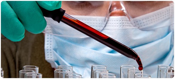 ยาโรคเกาต์ ยาโรคเกาต์