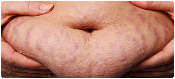 ลดได้ตัดได้ผอมได้ ลดได้ตัดได้ผอมได้