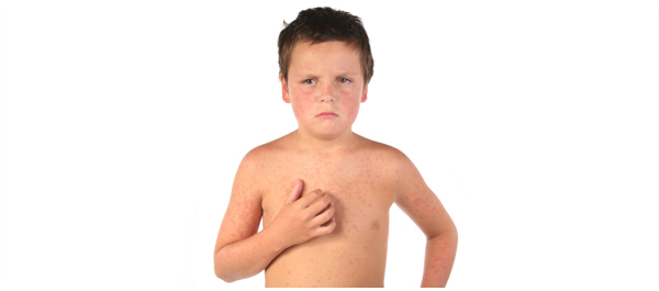 ลมเป็นพิษ