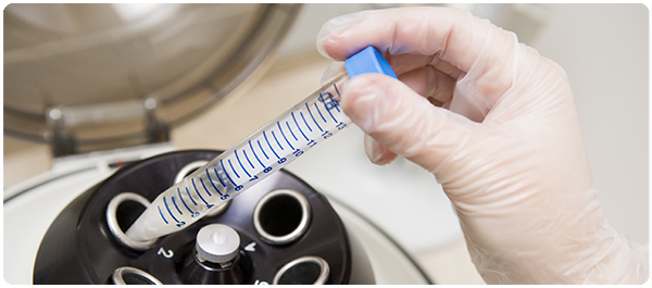 ลาสซาฟีเวอร์