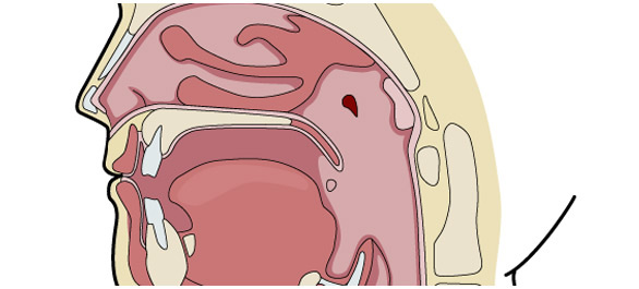 ลิ้นไก่ ลิ้นไก่