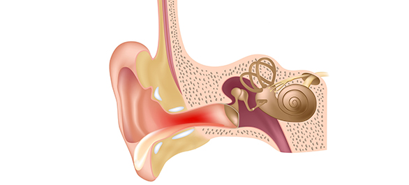 หูดับแต่ตับไม่ไหม้-2 หูดับแต่ตับไม่ไหม้-2