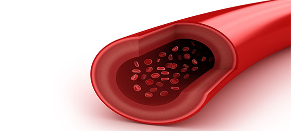 อาหารเช้าป้องกันหลอดเลือดแดงแข็งตัว-5