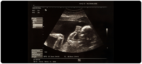 ฮอร์โมนรก ฮอร์โมนรก