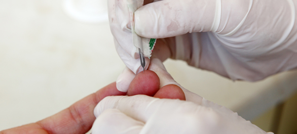 <a href='https://www.honestdocs.co/5-things-to-do-against-dengue-mosquito-fever' target='_blank'>เกล็ดเลือดต่ำ</a> <a href='https://www.honestdocs.co/atherosclerosis-treatment' target='_blank'>เกล็ดเลือด</a>ต่ำ