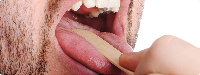 เจ็บคอ เจ็บคอ