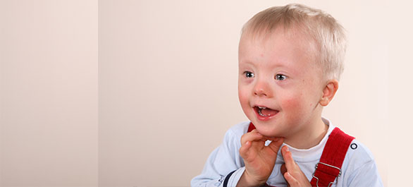 เด็กดาวน์ผู้พิเศษ-4 เด็กดาวน์ผู้พิเศษ-4