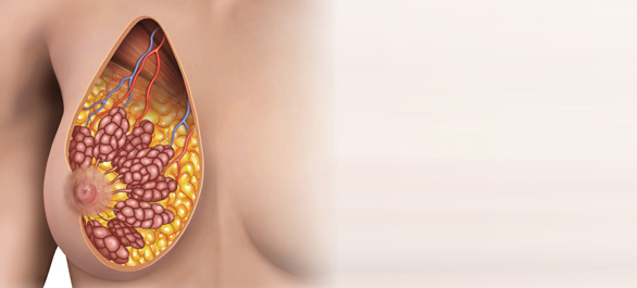 เต้านมคัดตึง เต้านมคัดตึง