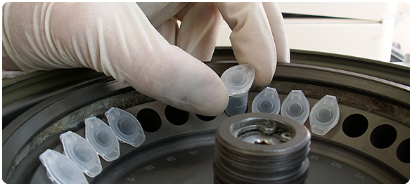 เฟอร์ริติน