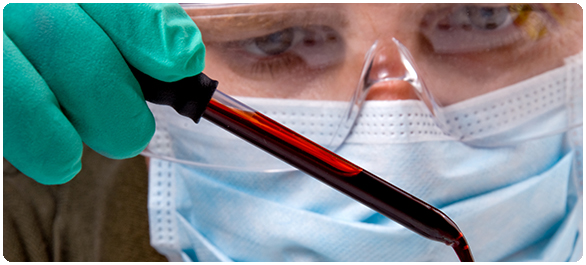 เม็ดเลือดขาวสูง