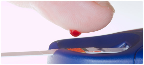 เรื่องของเกล็ดเลือด เรื่องของ<a href='https://www.honestdocs.co/atherosclerosis-treatment' target='_blank'>เกล็ดเลือด</a>