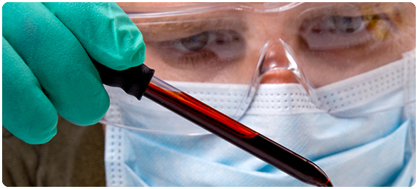 เลือดเป็นกรดจากกรดแลคติก เลือดเป็นกรดจากกรดแลคติก