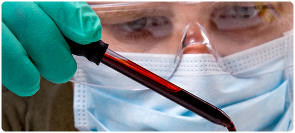 เลือดเป็นกรด เลือดเป็นกรด