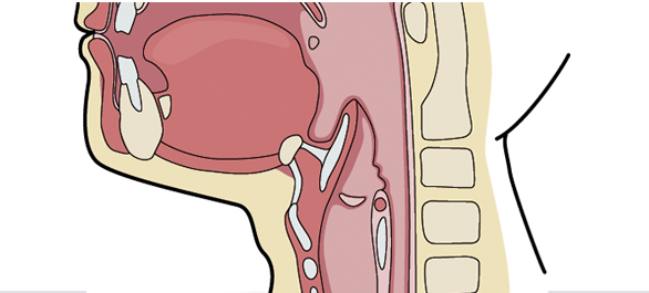 เสียงแหบ เสียงแหบ