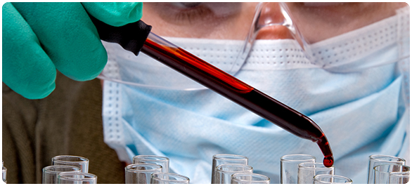 เอนไซม์การทำงานของตับ เอนไซม์การทำงานของตับ