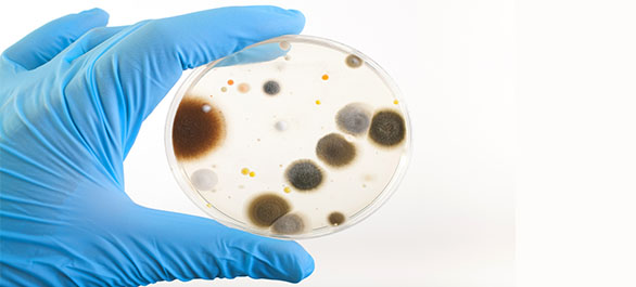 แบคทีเรียกินเนื้อ-2 แบคทีเรียกินเนื้อ-2