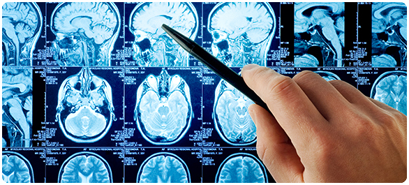 โปรแลกติน โปรแลกติน