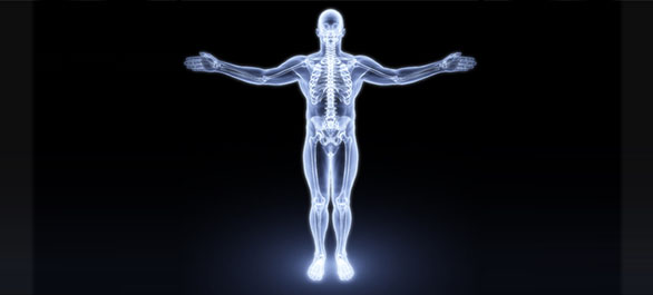 โรคกระดูกสันหลังอักเสบยึดติด-2 โรคกระดูกสันหลังอักเสบยึดติด-2