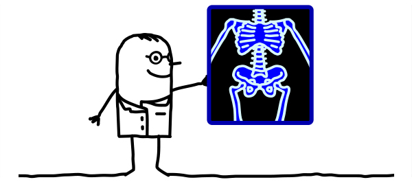 โรคกระดูกเปราะกรรมพันธุ์ โรคกระดูกเปราะกรรมพันธุ์