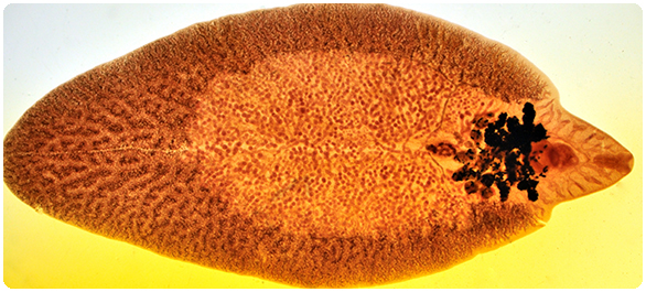 โรคประจำถิ่น <a href='https://www.honestdocs.co/ask/24766816' target='_blank'>โรคประจำถิ่น</a>