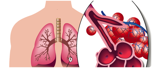 โรคปอด โรคปอด