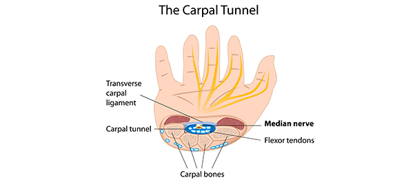 โรคฮิตของคนใช้มือ-3 โรคฮิตของคนใช้มือ-3