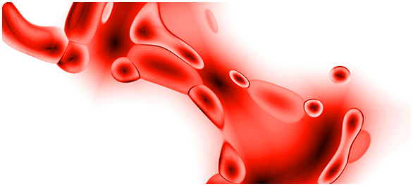 โลหิตจางจากไขกระดูกฝ่อ โลหิตจางจากไขกระดูกฝ่อ