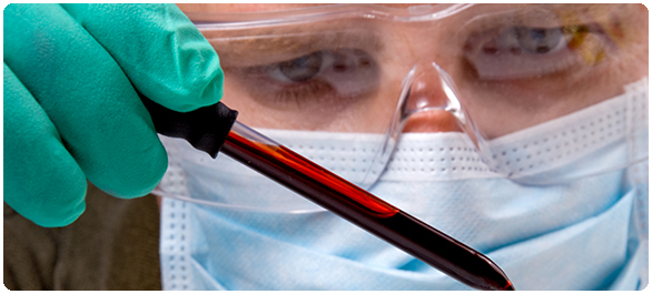 ไบคาร์โบเนต