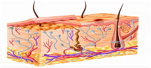 ไฝปาน ไฝปาน